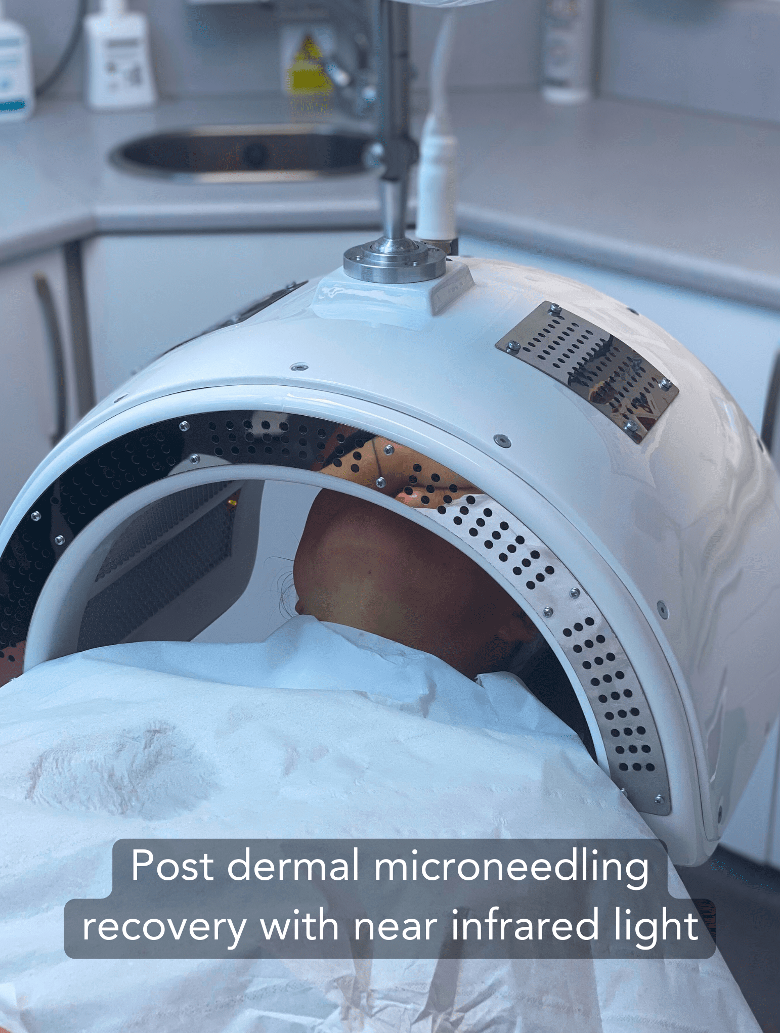 Dermalux near infrard light Dermalux post-microneedling recovery with near infrared